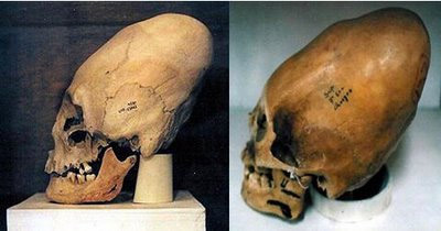 Экспонаты из Южной Америки: Перуанский череп